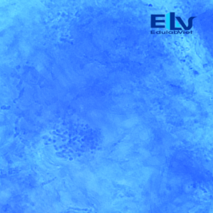 Tiêu bản bệnh phẩm lang ben – Lam kính nấm da