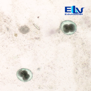 Tiêu bản trứng giun đũa Ascaris trên chó – Lam kính ký sinh trùng thú y